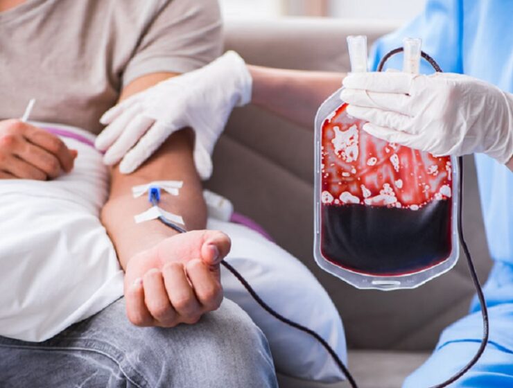 sindromi mielodisplastiche