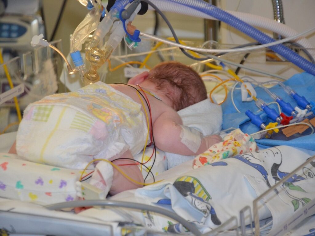 ospedale buzzi milano eczema