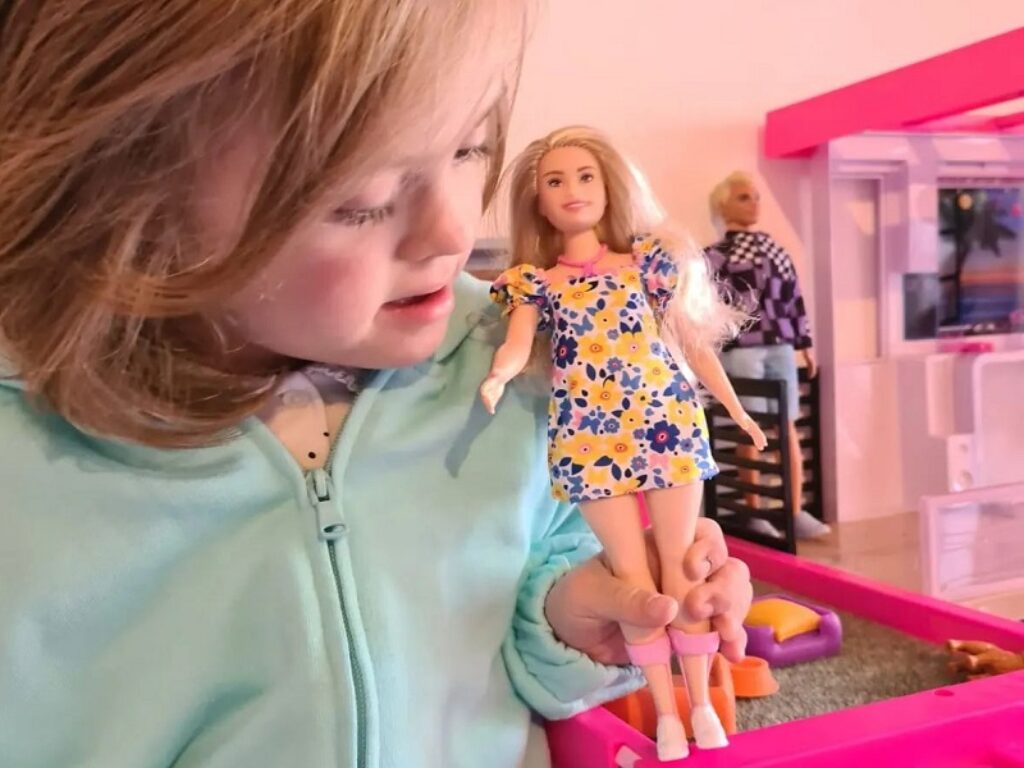 barbie sindrome di down