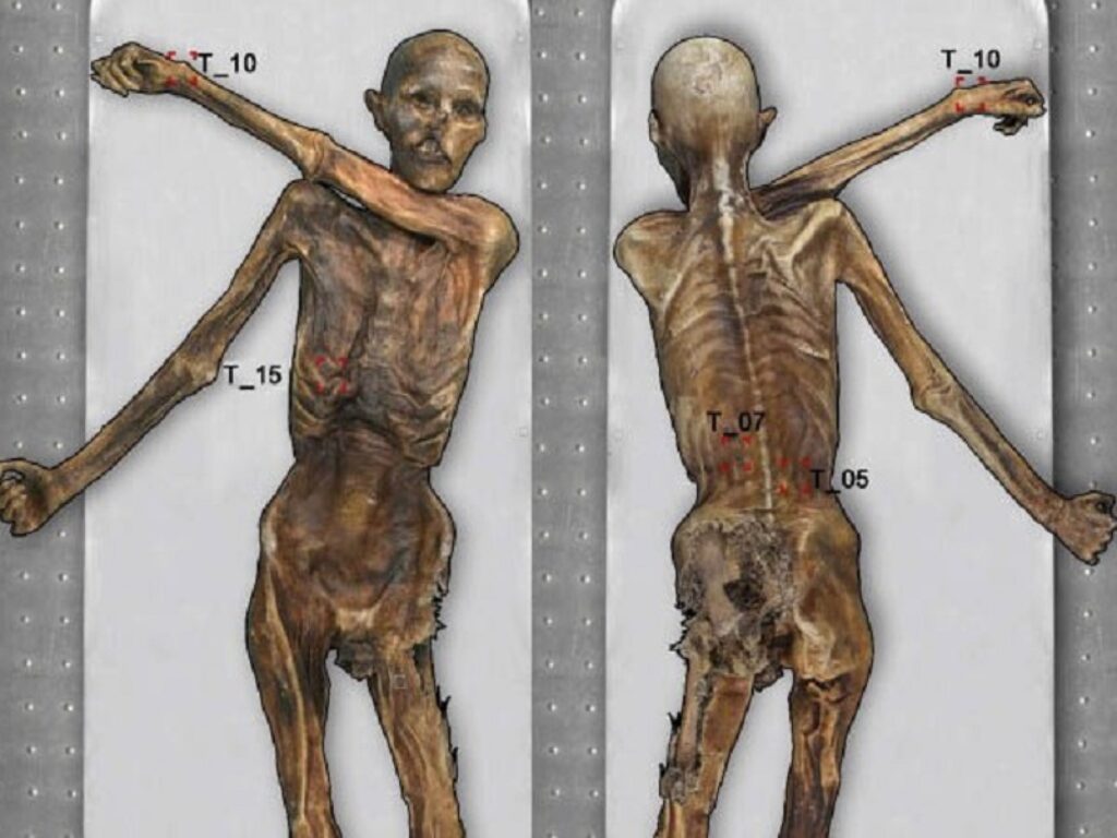 Ötzi