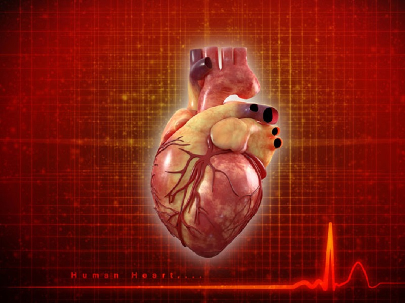 Intervento coronarico percutaneo