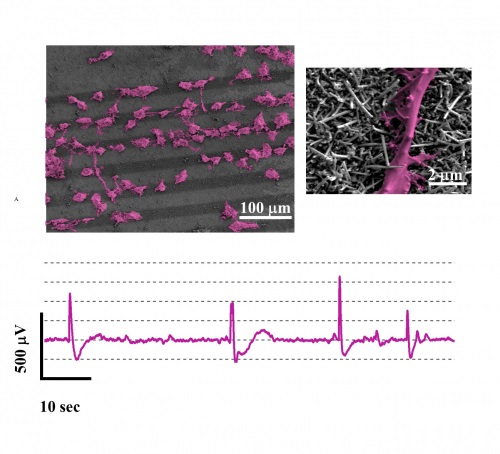 nanofili di silicio ipofisi