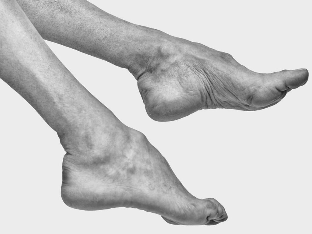 The Ballad of Human Mutations