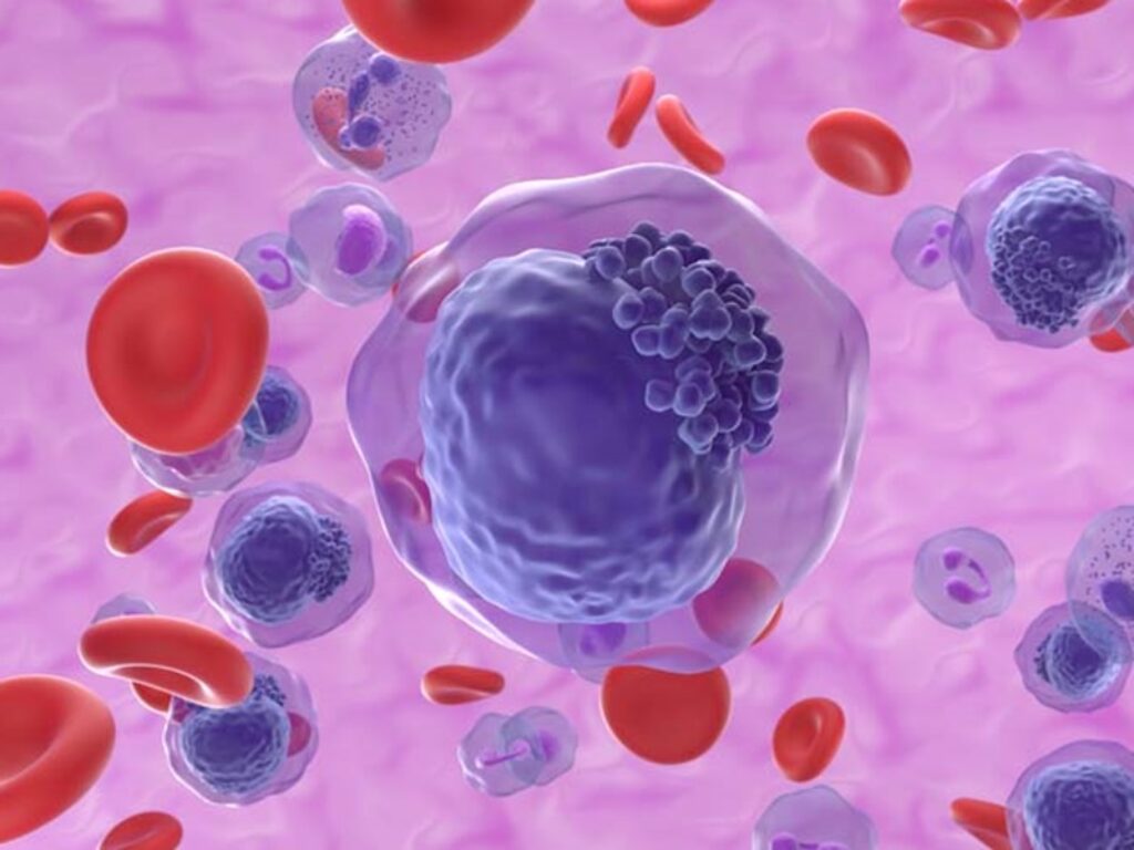 axicabtagene ciloleucel linfoma a grandi cellule