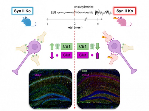 encefalopatie epilettiche
