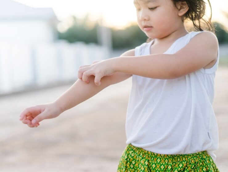 psoriasi apremiilast