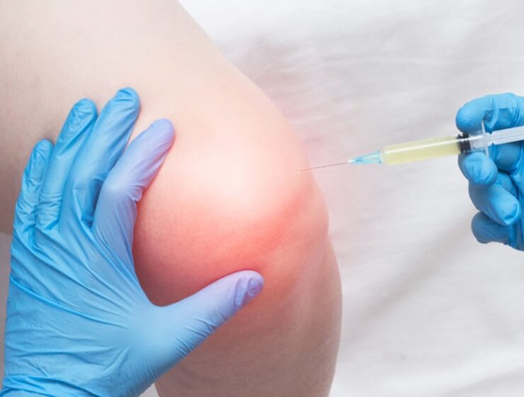 artrosi ortobiologia