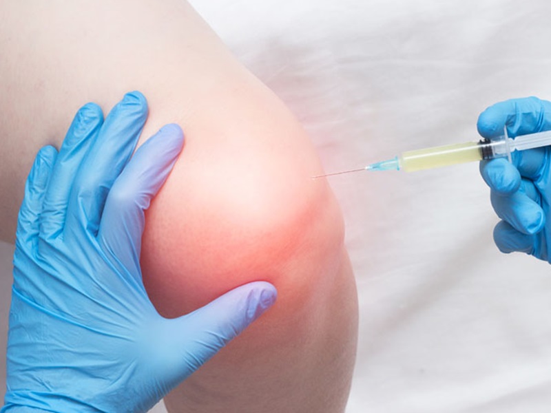 artrosi ortobiologia