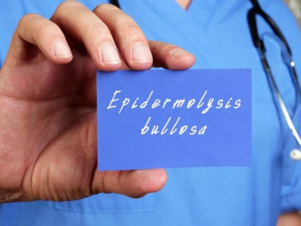 epidermolisi bollosa distrofica