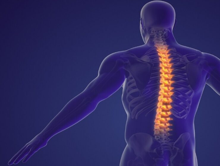 bupivacaina liposomiale