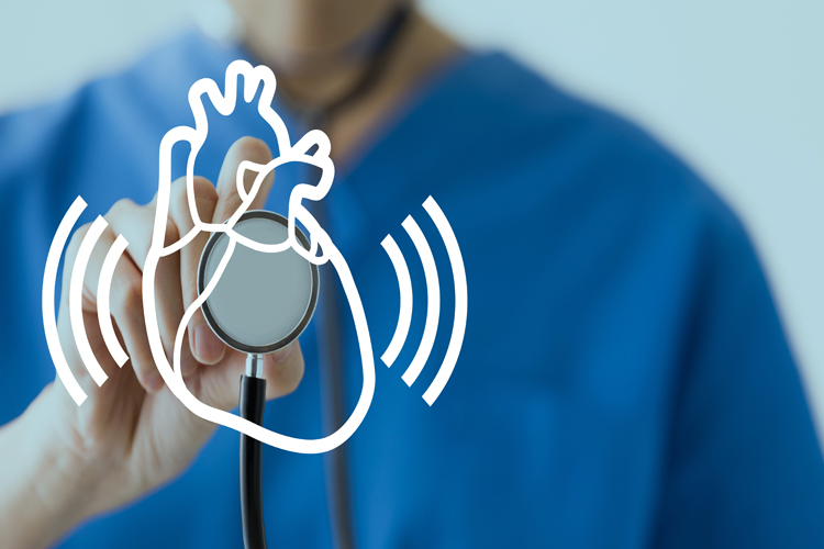 fibrillazione atriale