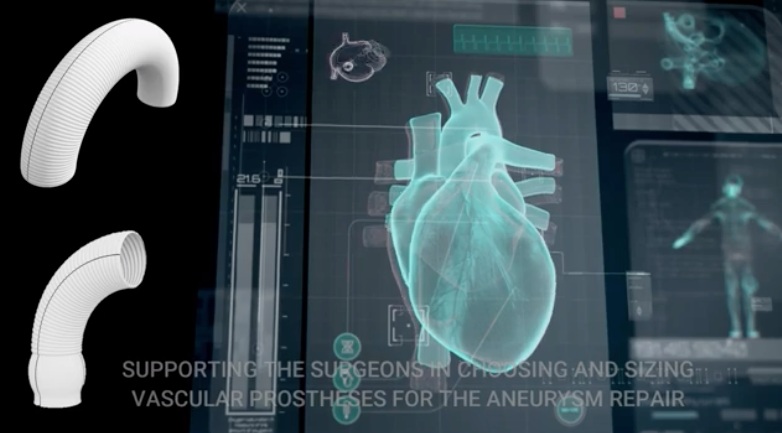 progetto pandora video