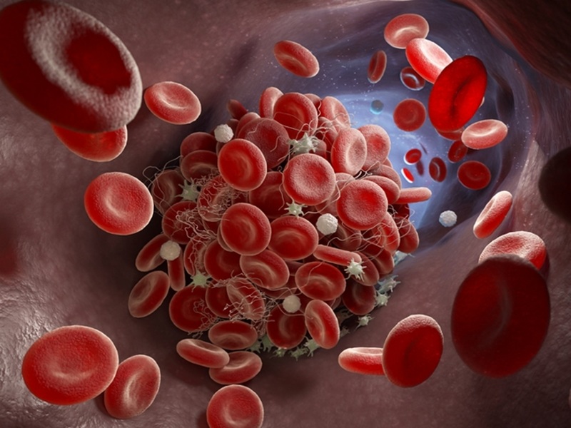 trombosi associata al cancro