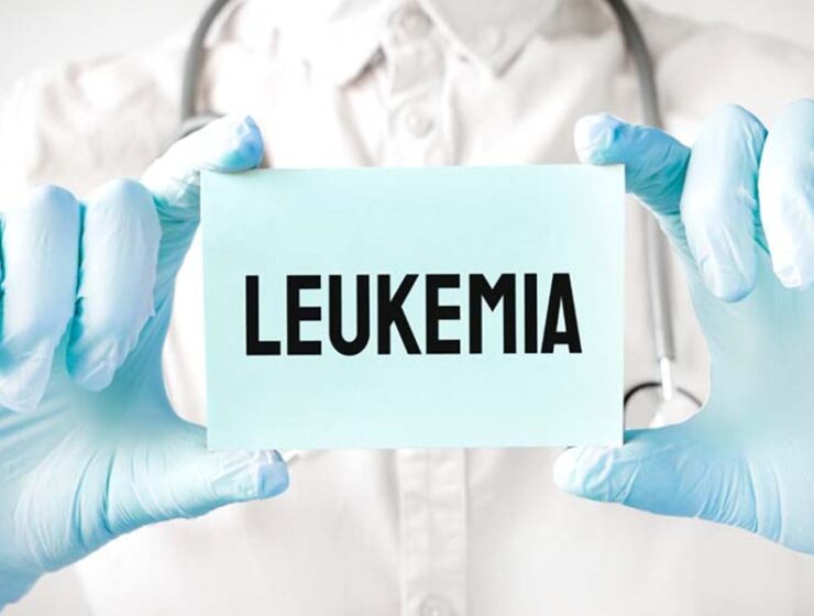 leucemia linfoblastica