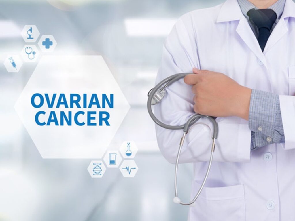 tumore ovarico