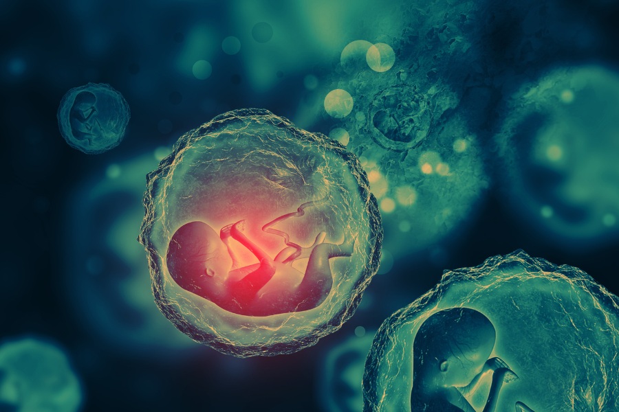 sindrome da trasfusione feto-fetale