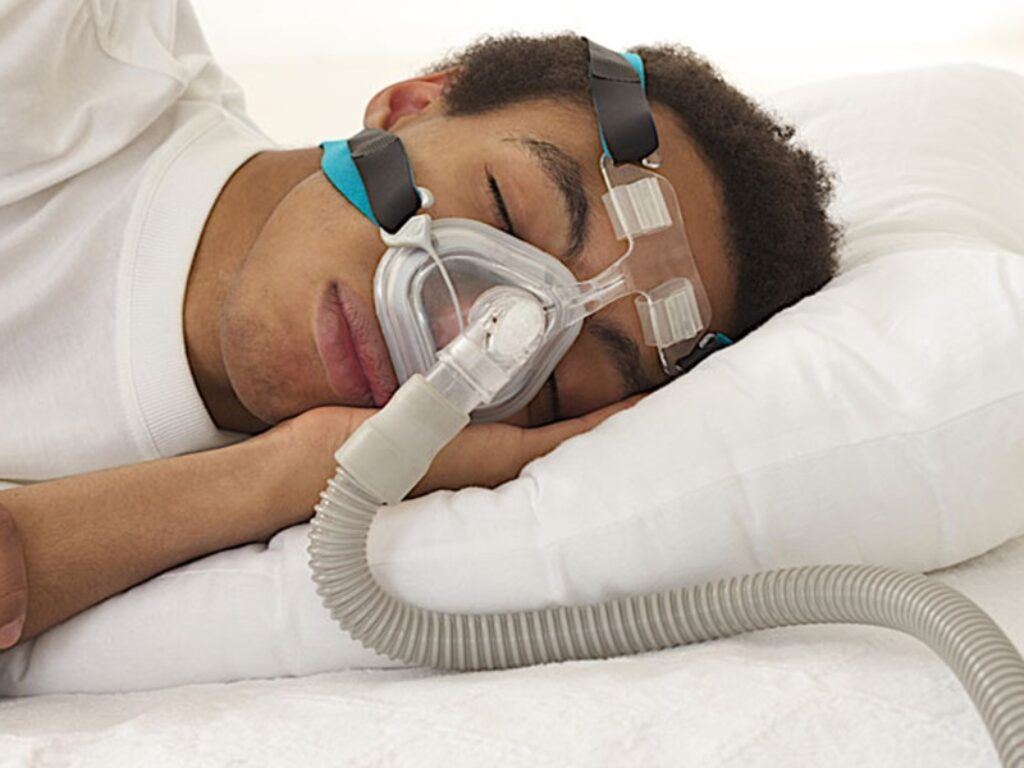 apnee ostruttive