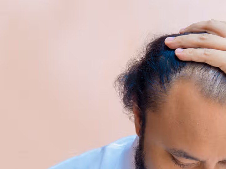 caduta dei capelli