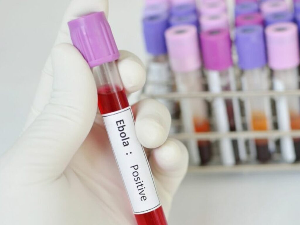 ebola