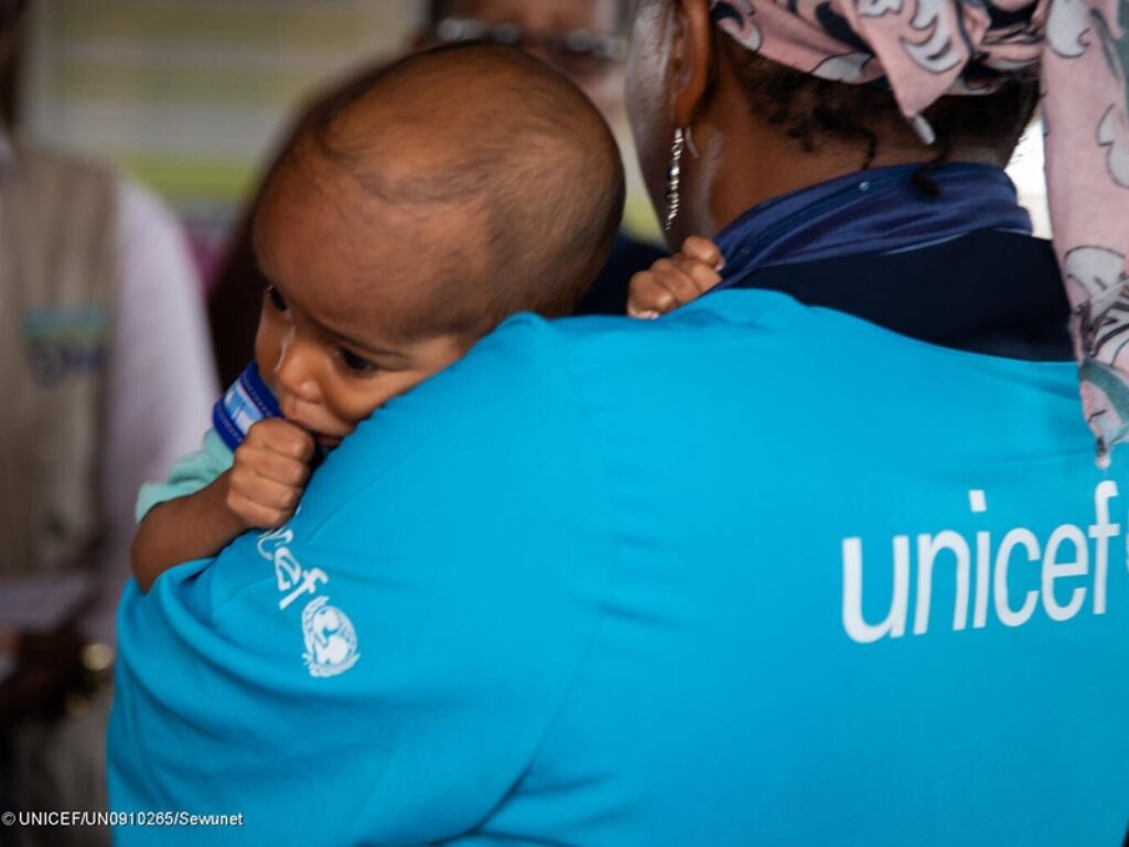 malnutrizione-somalia