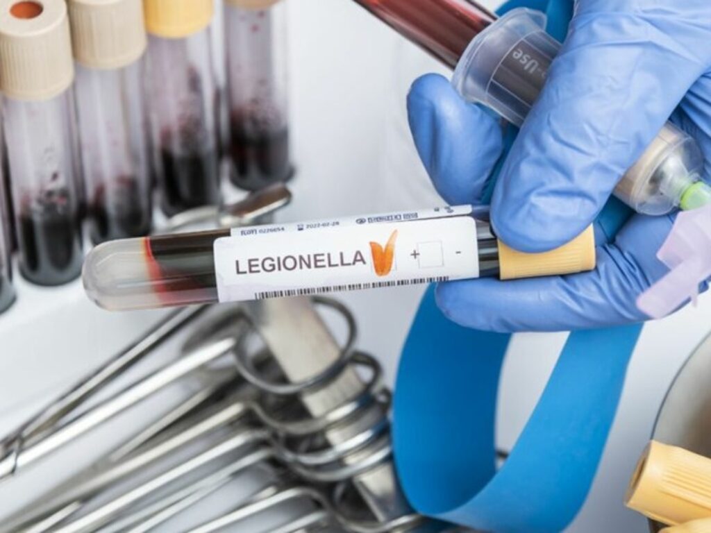 legionella
